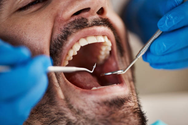 Best Walk-In Emergency Dental Services in Columbia Falls, MT